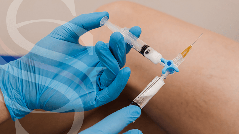 gilmar-santos-tratamentos-escleroterapia-espuma Imagem Tratamentos de Vasinhos e Varizes